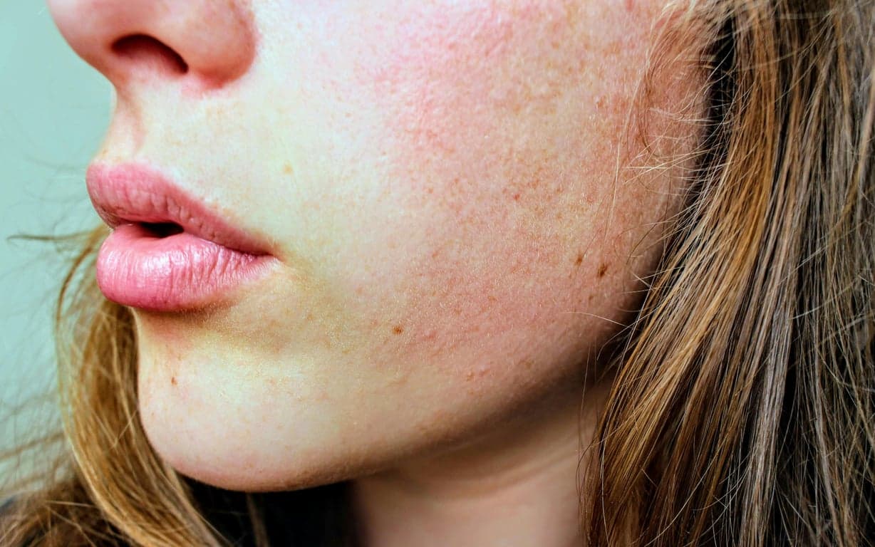 Best Skincare Routine for Dry Skin: Rehydrating Your Skin and Protecting Its Barrier
